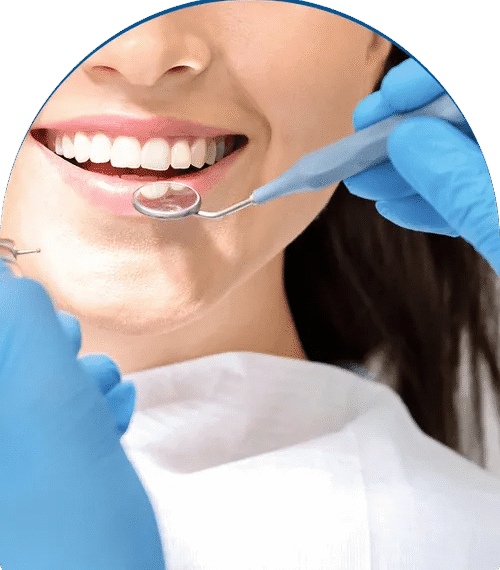 Fluoride Treatment for Adults: Does It Really Help Protect Your Teeth?